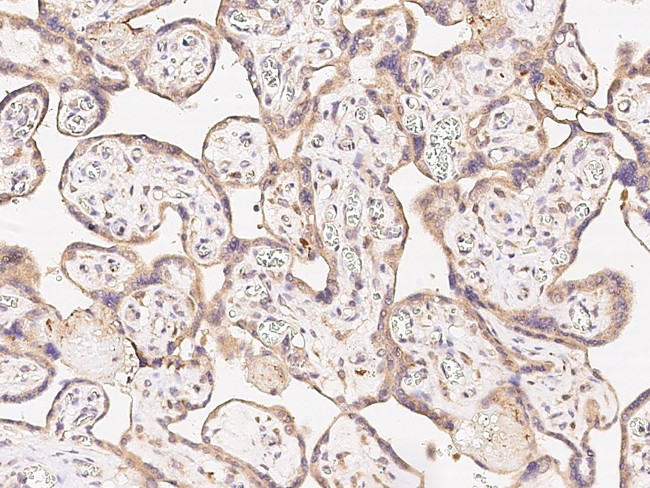 PTPN2 Antibody in Immunohistochemistry (Paraffin) (IHC (P))