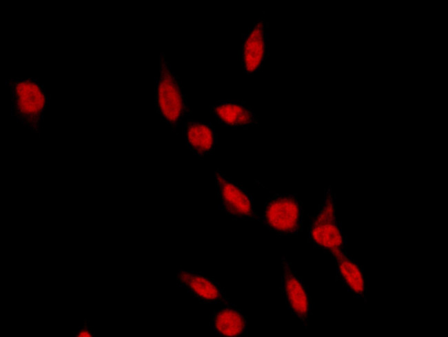 RAD18 Antibody in Immunocytochemistry (ICC/IF)