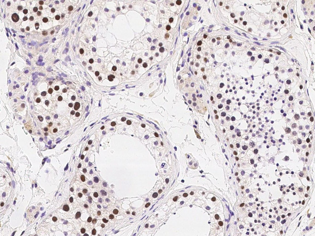 RAD18 Antibody in Immunohistochemistry (Paraffin) (IHC (P))