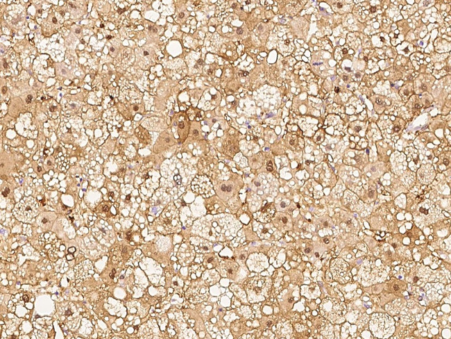 RBKS Antibody in Immunohistochemistry (Paraffin) (IHC (P))