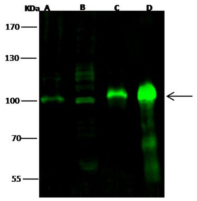 RBM15 Antibody in Western Blot (WB)