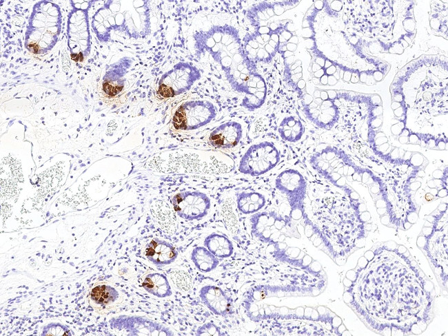 REG3A Antibody in Immunohistochemistry (Paraffin) (IHC (P))