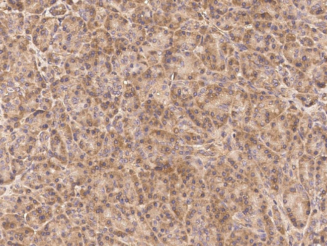 RIP3 Antibody in Immunohistochemistry (Paraffin) (IHC (P))