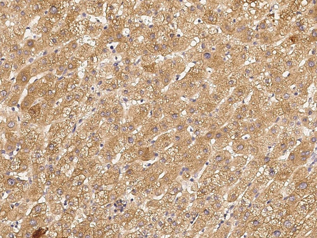 RIP3 Antibody in Immunohistochemistry (Paraffin) (IHC (P))