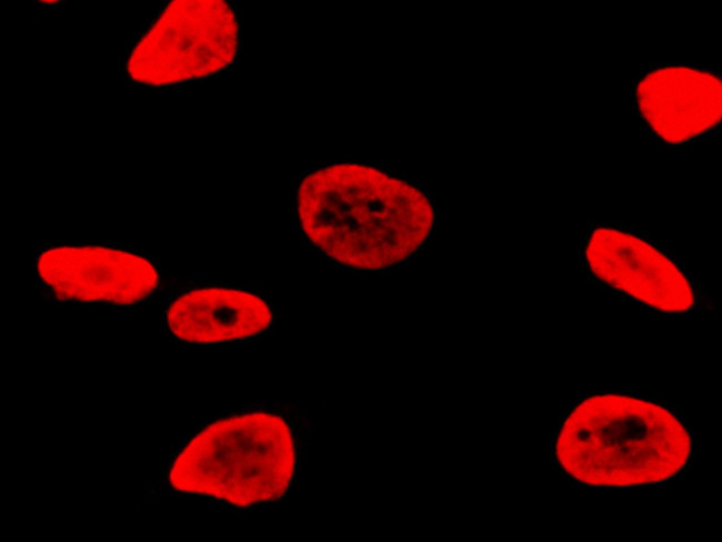 RSK3 Antibody in Immunocytochemistry (ICC/IF)