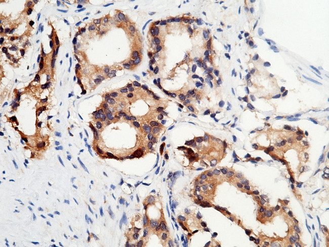 p53R2 Antibody in Immunohistochemistry (Paraffin) (IHC (P))