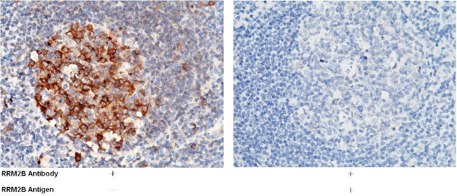 p53R2 Antibody in Immunohistochemistry (Paraffin) (IHC (P))