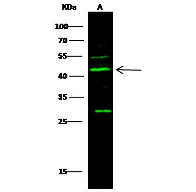 p53R2 Antibody in Western Blot (WB)