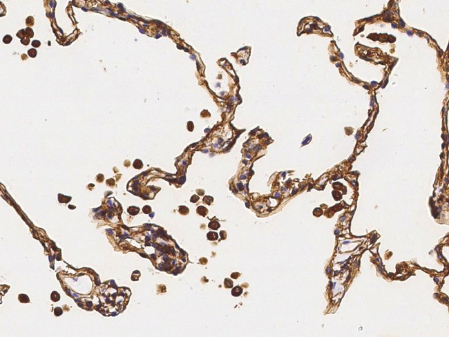 S100A10 Antibody in Immunohistochemistry (Paraffin) (IHC (P))