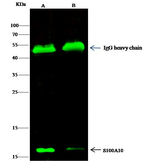 S100A10 Antibody in Immunoprecipitation (IP)