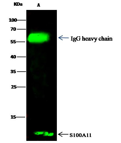 S100A11 Antibody in Immunoprecipitation (IP)