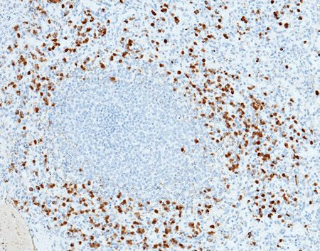 S100A12 Antibody in Immunohistochemistry (Paraffin) (IHC (P))