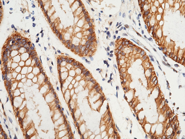 S100A16 Antibody in Immunohistochemistry (Paraffin) (IHC (P))