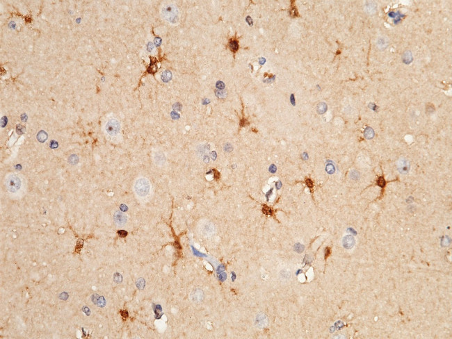 S100A16 Antibody in Immunohistochemistry (Paraffin) (IHC (P))