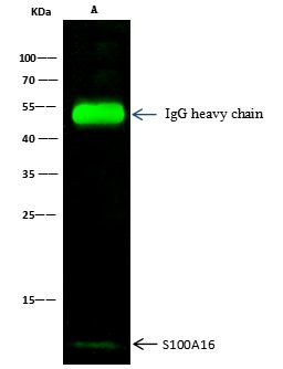 S100A16 Antibody in Immunoprecipitation (IP)