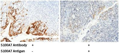 S100A7 Antibody in Immunohistochemistry (Paraffin) (IHC (P))