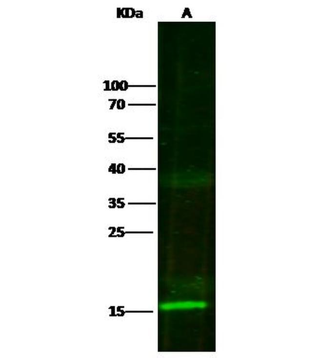 S100A7 Antibody in Western Blot (WB)