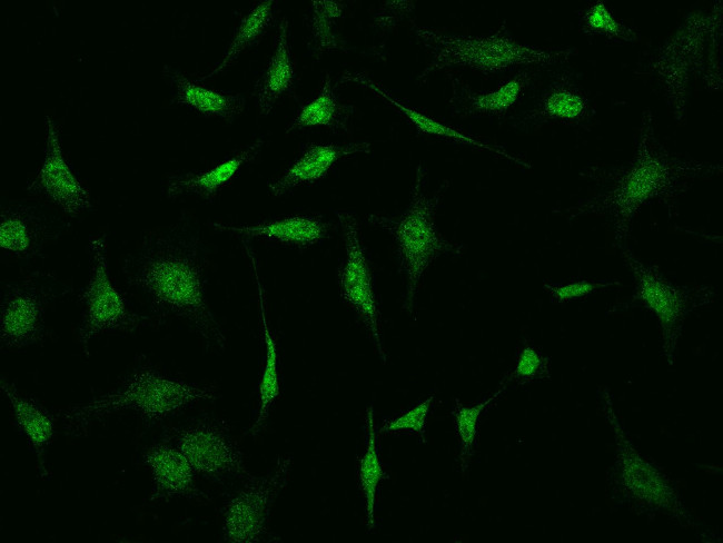 S100P Antibody in Immunocytochemistry (ICC/IF)