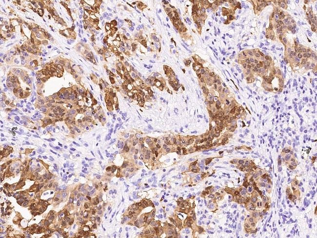 S100P Antibody in Immunohistochemistry (Paraffin) (IHC (P))