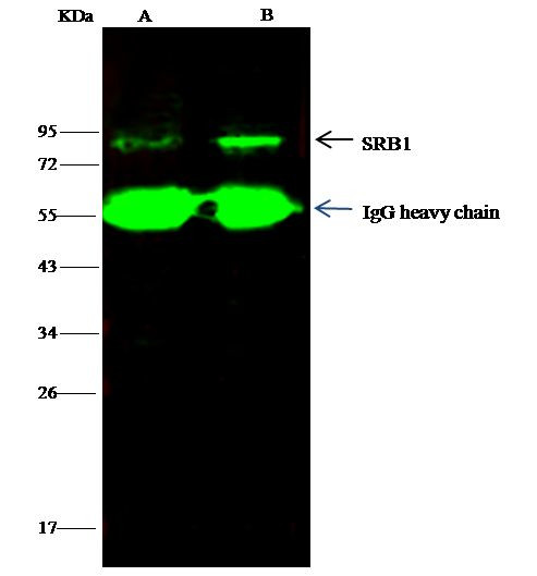 SR-BI Antibody in Immunoprecipitation (IP)