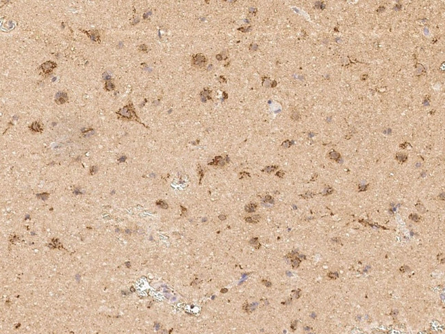 SCN2B Antibody in Immunohistochemistry (Paraffin) (IHC (P))