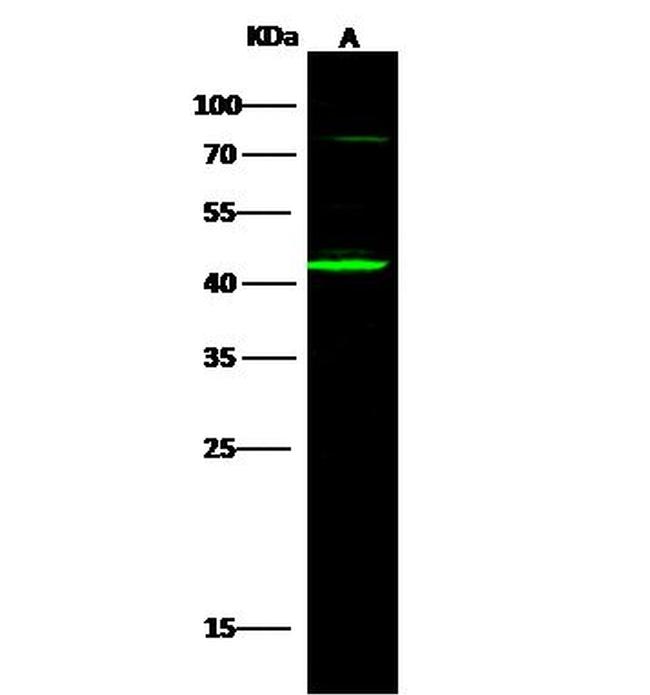 SERPINB3 Antibody in Western Blot (WB)