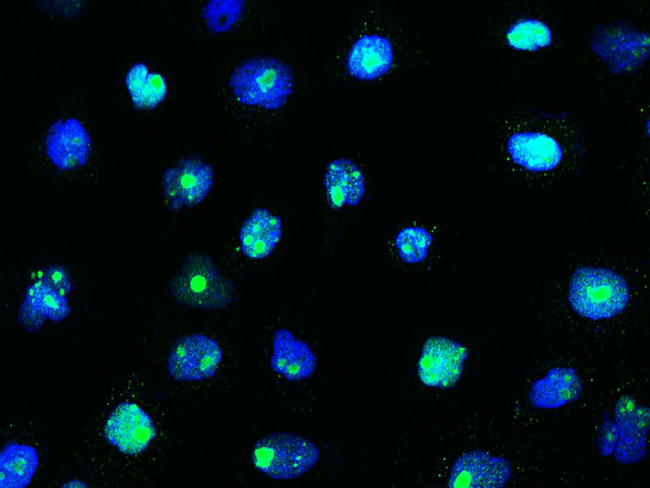 SIPA1 Antibody in Immunocytochemistry (ICC/IF)