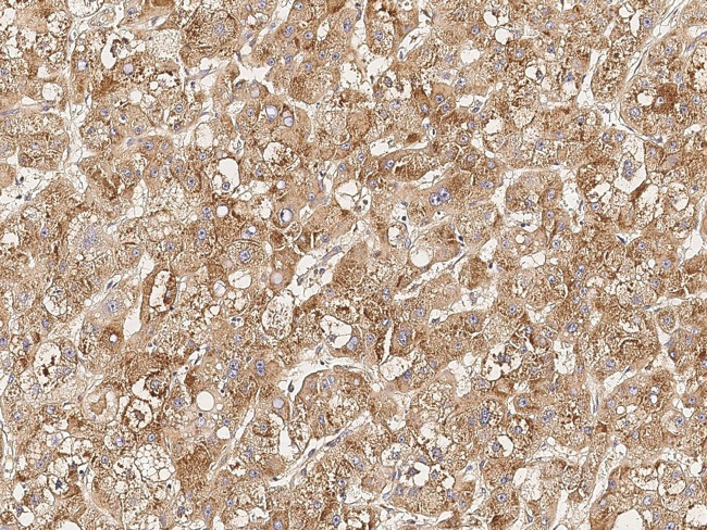 SLC27A5 Antibody in Immunohistochemistry (Paraffin) (IHC (P))