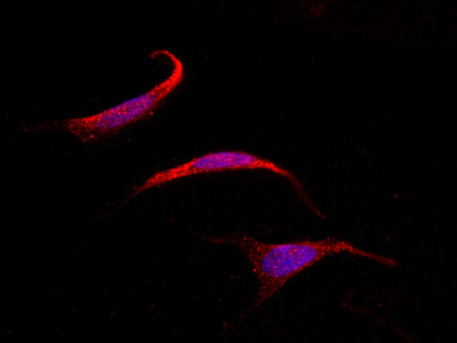 SOCS4 Antibody in Immunocytochemistry (ICC/IF)