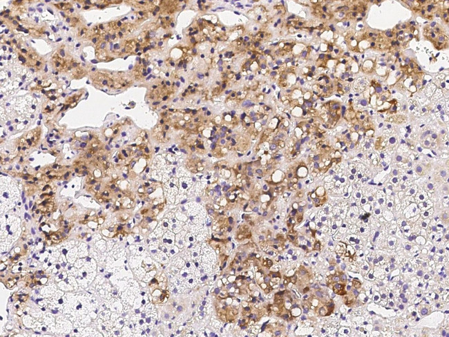 SOCS4 Antibody in Immunohistochemistry (Paraffin) (IHC (P))