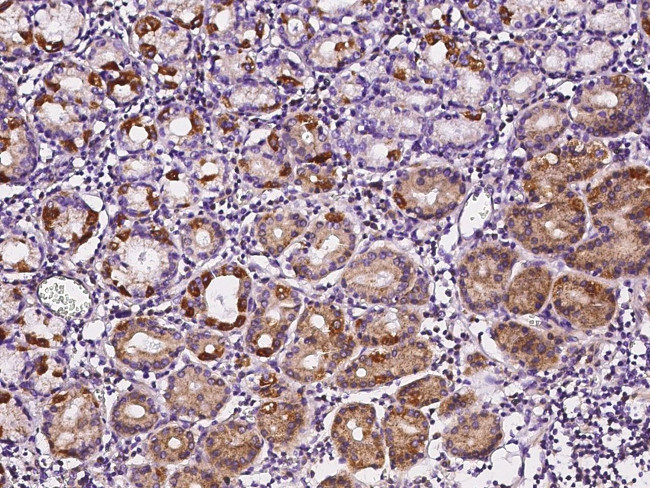 SOCS4 Antibody in Immunohistochemistry (Paraffin) (IHC (P))