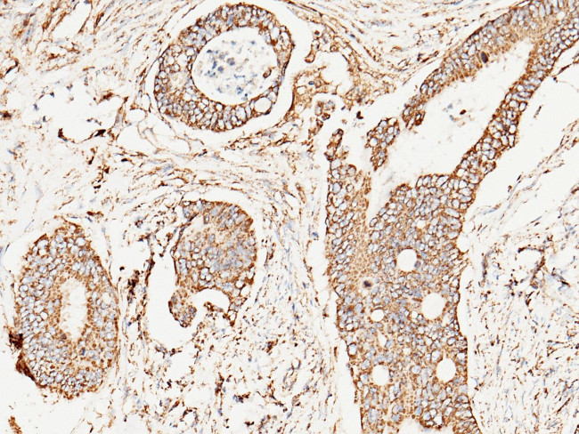 SOD2 Antibody in Immunohistochemistry (Paraffin) (IHC (P))