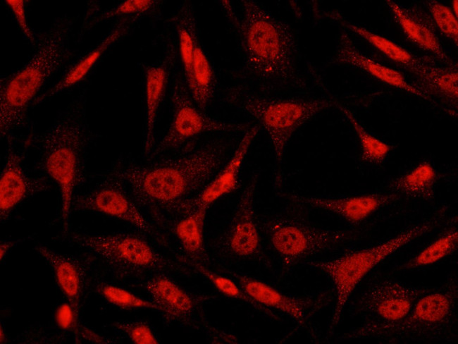 STAT4 Antibody in Immunocytochemistry (ICC/IF)