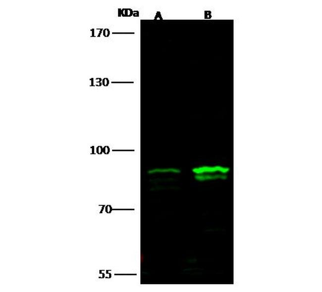 STAT4 Antibody in Western Blot (WB)