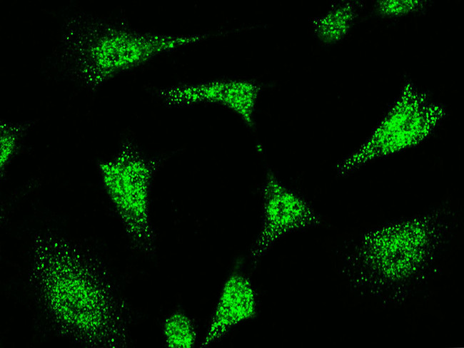 STAT5 alpha Antibody in Immunocytochemistry (ICC/IF)