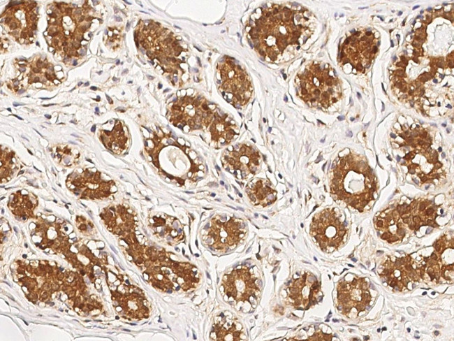 STAT5 alpha Antibody in Immunohistochemistry (Paraffin) (IHC (P))