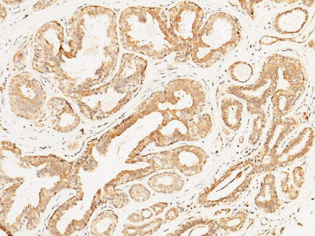 STIM1 Antibody in Immunohistochemistry (Paraffin) (IHC (P))