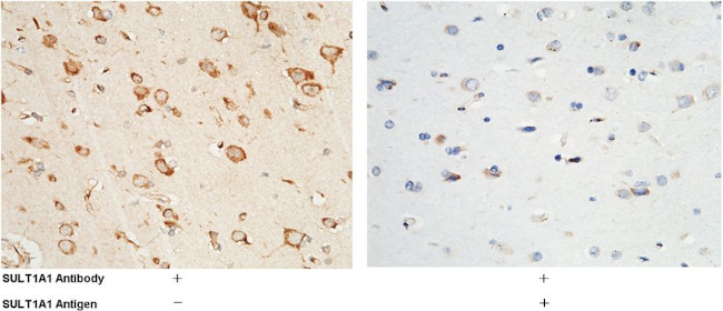 SULT1A1 Antibody in Immunohistochemistry (Paraffin) (IHC (P))