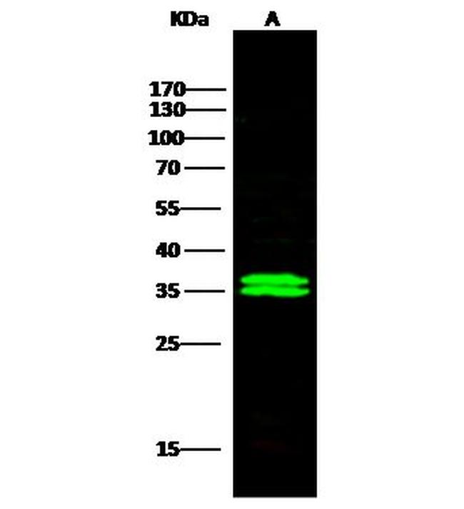 SULT1A1 Antibody in Western Blot (WB)