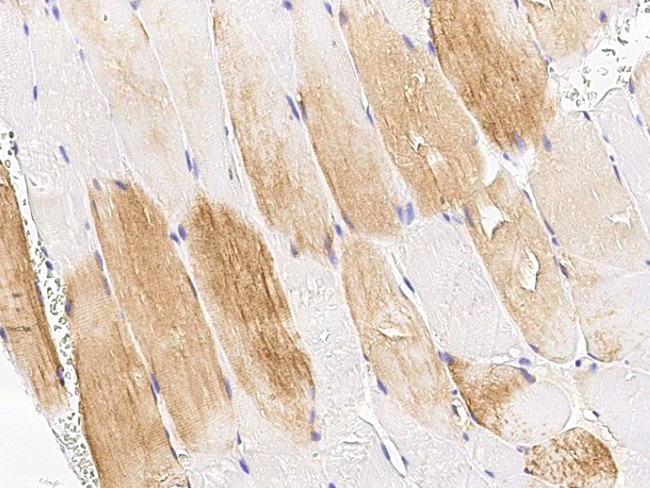 TET1 Antibody in Immunohistochemistry (Paraffin) (IHC (P))