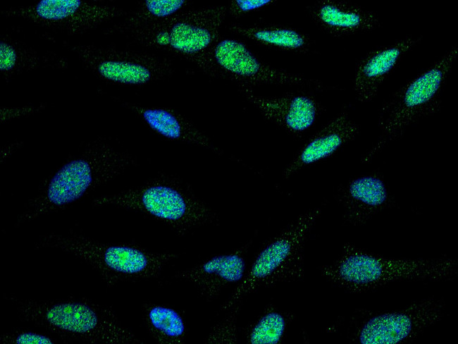 TLK1 Antibody in Immunocytochemistry (ICC/IF)