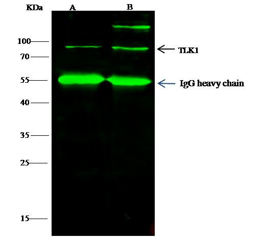 TLK1 Antibody in Immunoprecipitation (IP)