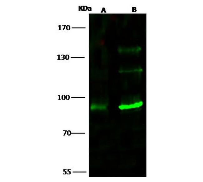 TLK1 Antibody in Western Blot (WB)