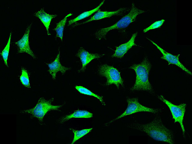 TLR3 Antibody in Immunocytochemistry (ICC/IF)