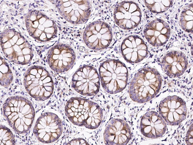 TLR3 Antibody in Immunohistochemistry (Paraffin) (IHC (P))