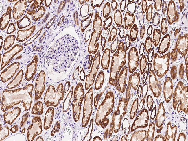 TLR3 Antibody in Immunohistochemistry (Paraffin) (IHC (P))