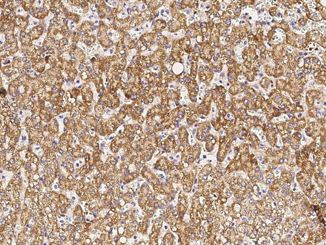 CD264 (TRAIL-R4) Antibody in Immunohistochemistry (Paraffin) (IHC (P))