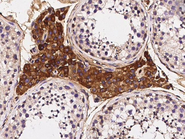 CD264 (TRAIL-R4) Antibody in Immunohistochemistry (Paraffin) (IHC (P))