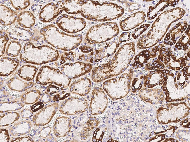 CD264 (TRAIL-R4) Antibody in Immunohistochemistry (Paraffin) (IHC (P))