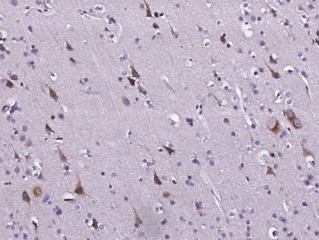 TNFR1 Antibody in Immunohistochemistry (Paraffin) (IHC (P))